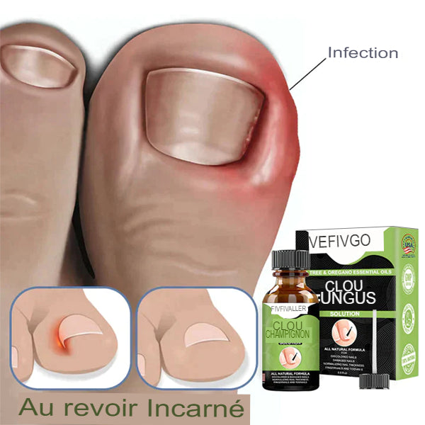 CC™ Serom pour les ongle Efficace 100%